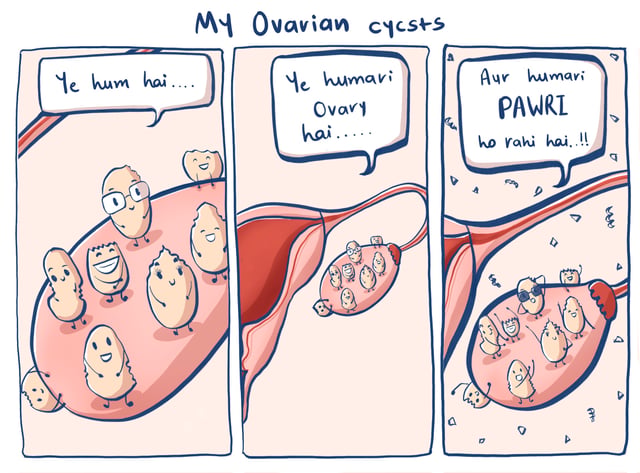Three-panel comic of personified ovarian cysts speaking in Hindi.